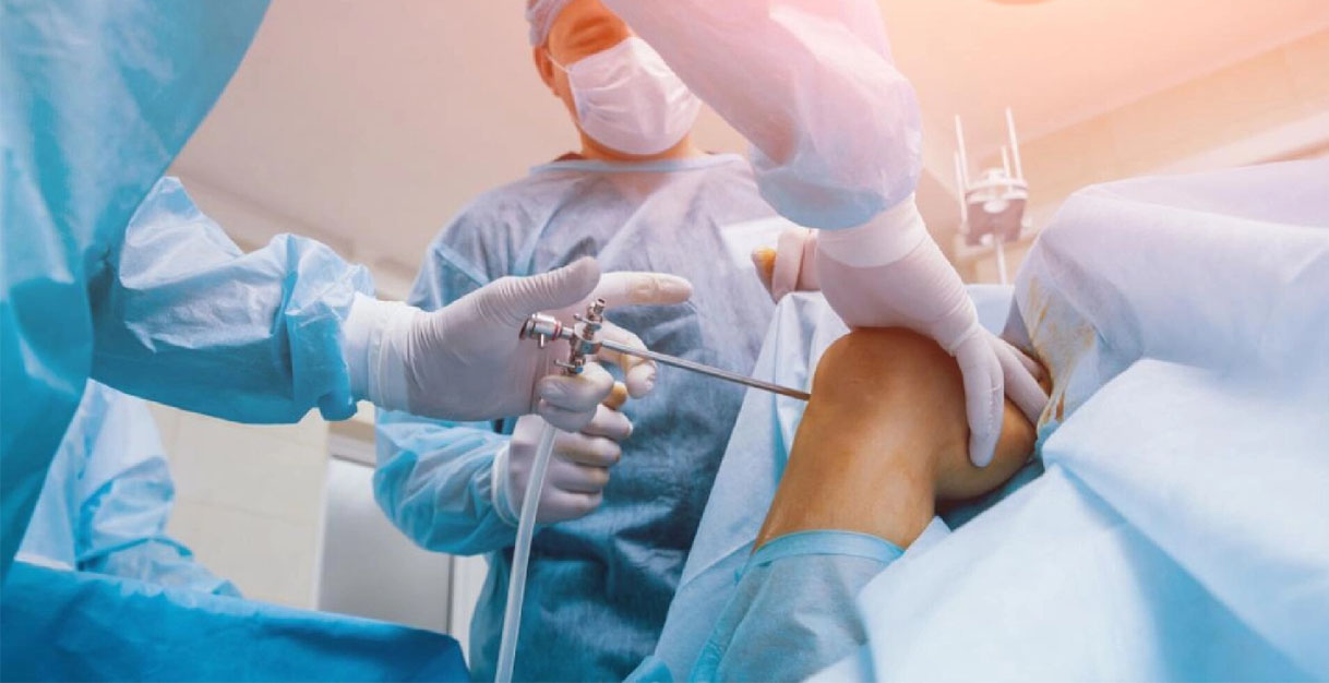knee-arthroscopy